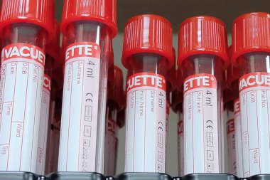BERLIN, GERMANY - June 06, 2016: BD Vacutainer blood collection tubes