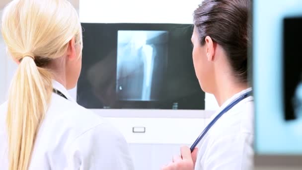 女医生检查 x 光的结果 — 图库视频影像