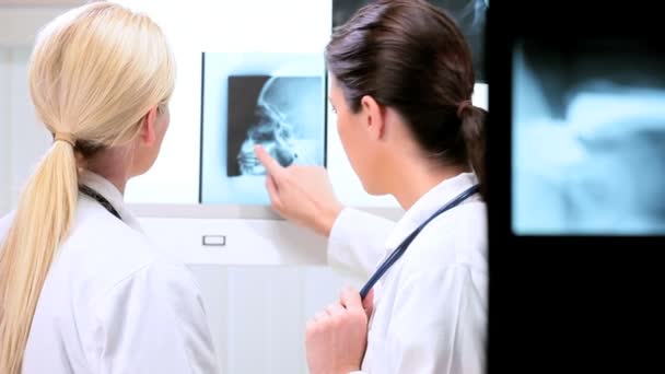 Médicos Femeninos Viendo Pacientes Resultados de Rayos X — Vídeo de stock