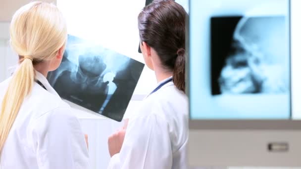 Young Female Doctors Looking at X-Rays — Stock Video