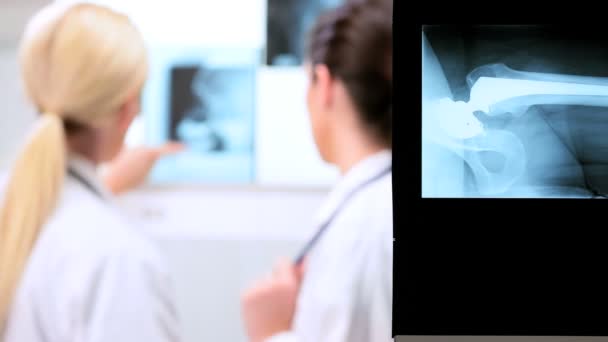 Médicos de Radiología inspeccionando películas de rayos X — Vídeos de Stock