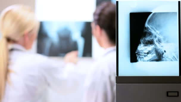 Młoda kobieta lekarze patrząc na zdjęcia rentgenowskie — Wideo stockowe