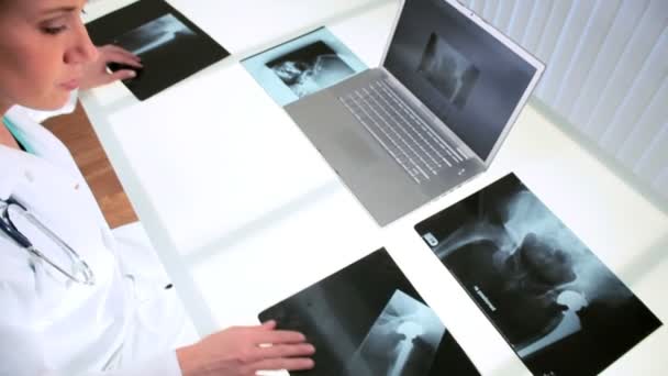 Doctor en Radiología Examinando Rayos X — Vídeos de Stock