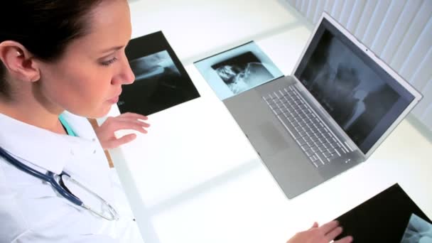 Doctor en Radiología Examinando Rayos X — Vídeo de stock