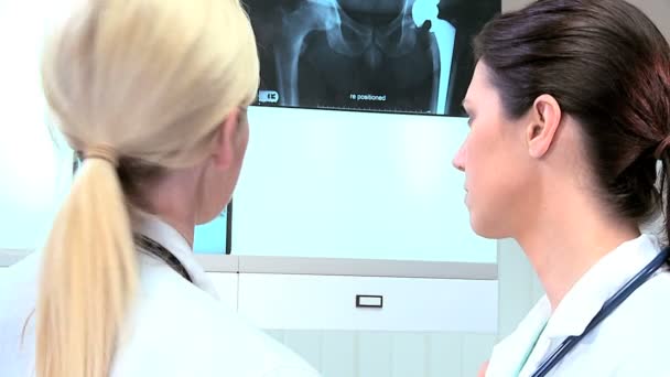 Young Female Doctors Looking at X-Rays — Stock Video