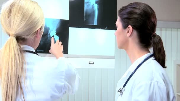 Kaukasische artsen bestudering van x-ray resultaten — Stockvideo