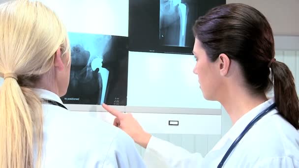 Médicos do sexo feminino visualizando resultados de raios-X de pacientes — Vídeo de Stock