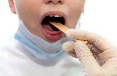 Doktorun eli lastik eldivenli hasta bir çocuğun ağzını inceliyor. İlaçlar. Çocuk doktoru.