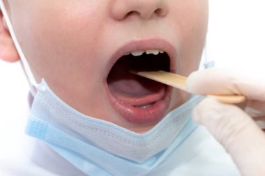 Lastik eldivenli bir dişçi çocuğun ağzını özel bir aletle muayene eder. Çocuğun sağlığı için. Hasta dişler.