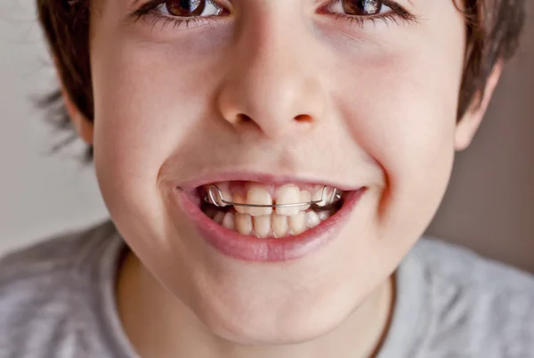 Glücklicher Teenager mit Zahnspange — Stockfoto