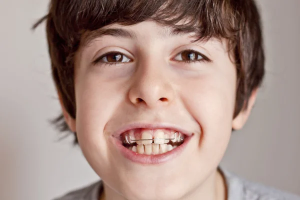 Diş teli ile mutlu teen — Stok fotoğraf