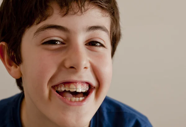 Adolescente feliz com aparelho — Fotografia de Stock