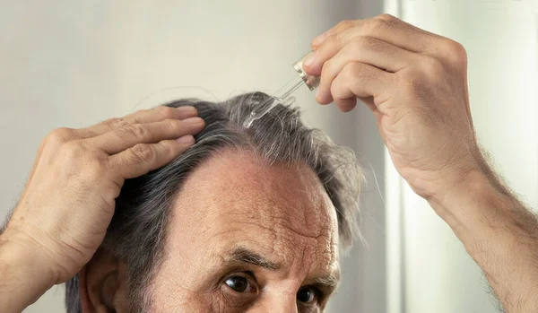 Old Man Dropping Serum His Hair — Stock Photo, Image