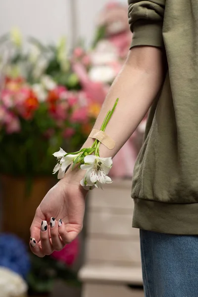 Alstroemeria Bevestigd Aan Een Hand Met Pleisterbanden Natuurlijke Frisheid Vrouwelijke — Stockfoto