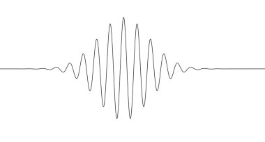 sinüs azalma artış hattı