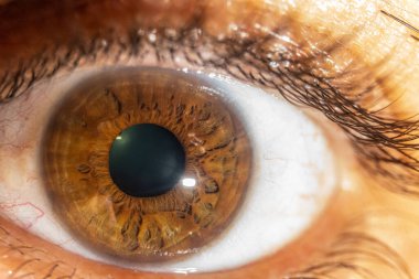 Macro photography of the right eye with illumination