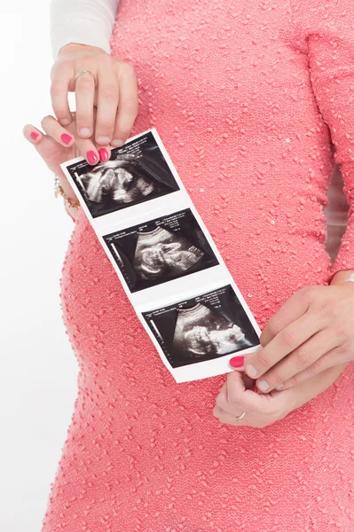 Felice donna incinta con suo marito che mostra l'immagine ecografica del bambino — Foto Stock