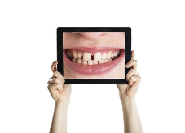 Tandheelkundige close-up met Tablet PC — Stockfoto