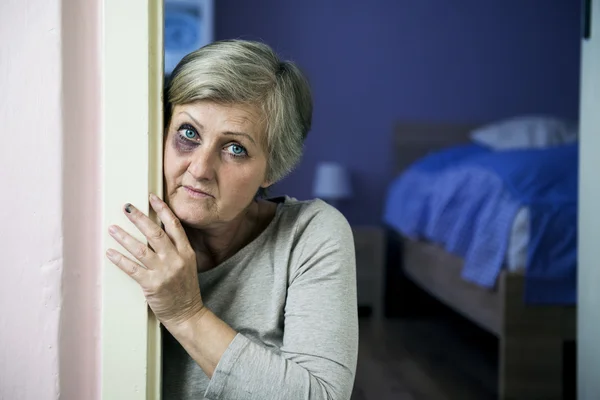 Slachtoffer van huiselijk geweld — Stockfoto