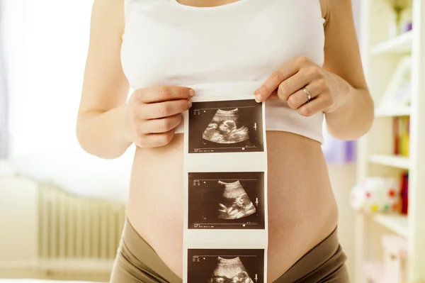 Ultrasound scan pictures — Stock Photo, Image