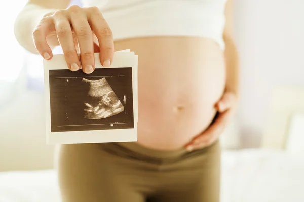 Ultrasound scan picture — Stock Photo, Image