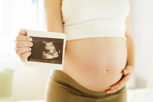 Ultrasound scan picture — Stock Photo, Image