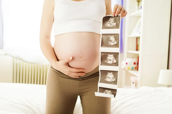 Ultrasound scan pictures — Stock Photo, Image