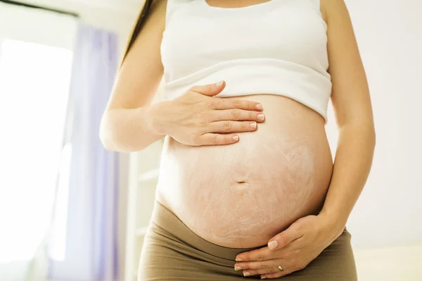 Frau trägt Feuchtigkeitscreme auf — Stockfoto