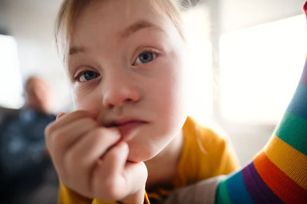 Nahaufnahme eines traurigen kleinen Mädchens mit Down-Syndrom, das auf dem Bett ihres Vaters liegt und in die Kamera blickt. — Stockfoto