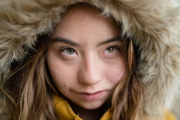 Close-up de jovem com síndrome de Down weraing capa e olhando para a câmera — Fotografia de Stock