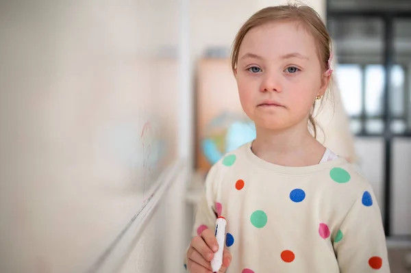 Ein Kleines Schulmädchen Mit Syndrom Steht Vor Whiteboard Und Blickt — Stockfoto