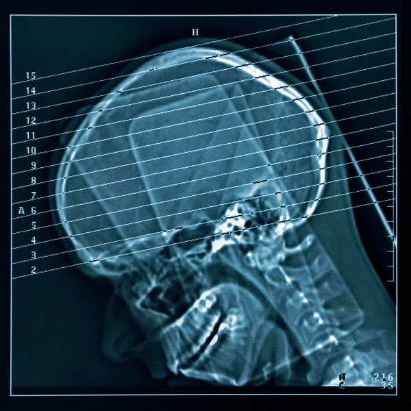 Obrázek tomografie — Stock fotografie