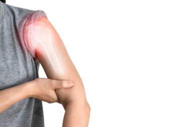 Inflammation of the muscles and bones of the arm