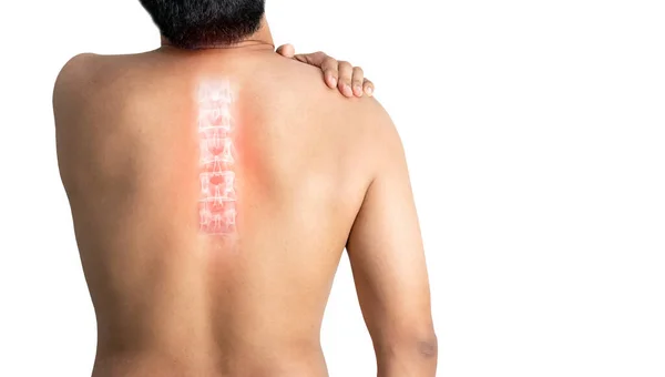 Inflamed Human Spine Pain White Background — Stock Photo, Image