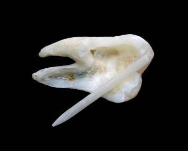 bir insan dişi dan kesit görünümü