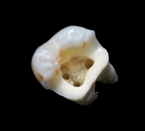 Struktur anatomi dari gigi — Stok Foto