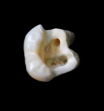 Diş anatomik yapısı