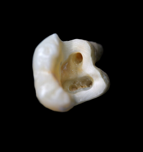 Anatomical structure of the tooth