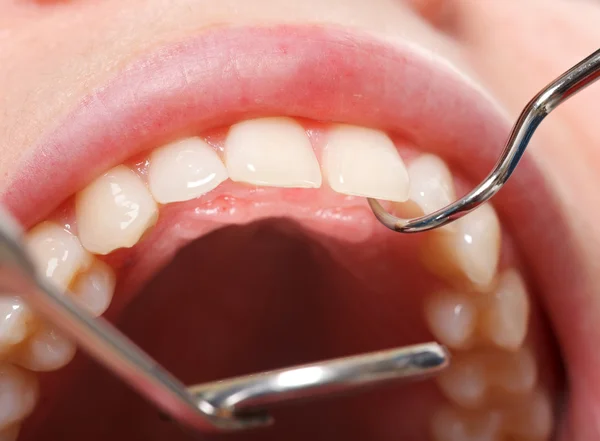 Omfattande dental undersökning — Stockfoto