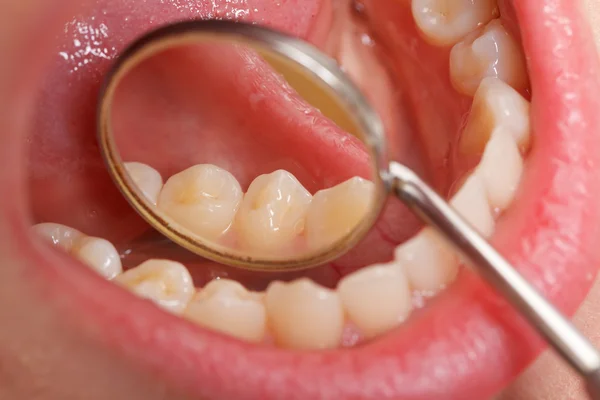 Комплексное обследование зубов — стоковое фото