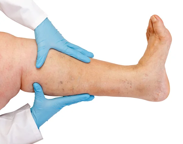 Lower limb examination — Stock Photo, Image