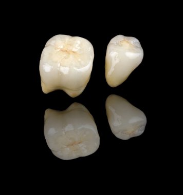 Seramik kron