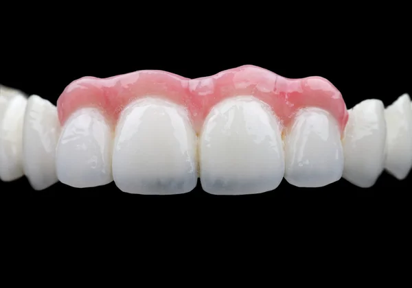 Dientes de porcelana — Foto de Stock