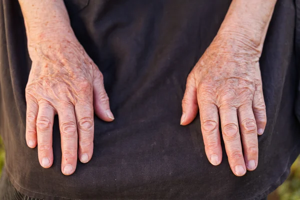 高齢者の女性の手 — ストック写真
