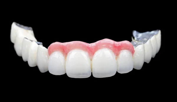 Фарфоровые зубы — стоковое фото