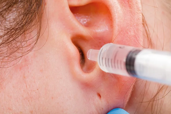 EAR wash — Stockfoto