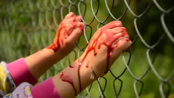 Child asks for help in blood. Violence against children. Child in the blood of the fence, asks for help — Stock Video