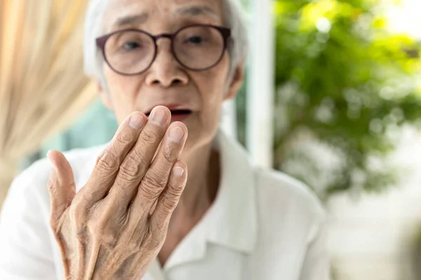 手拉手 亚洲老年妇女检查呼吸 老年人做口臭测试 气味难闻 牙齿和牙龈问题 口腔菌 牙齿护理理念 — 图库照片