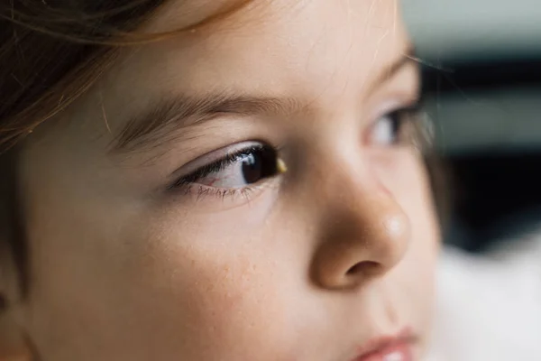 Primer plano del niño enfermo con conjuntivitis, ojo rojo con pus —  Fotos de Stock