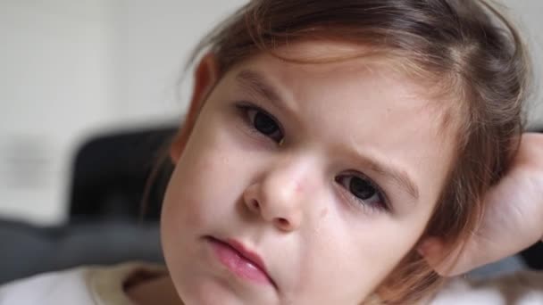 Κοντινό πλάνο του παιδιού άρρωστο με επιπεφυκίτιδα, κόκκινο μάτι με πύον — Αρχείο Βίντεο